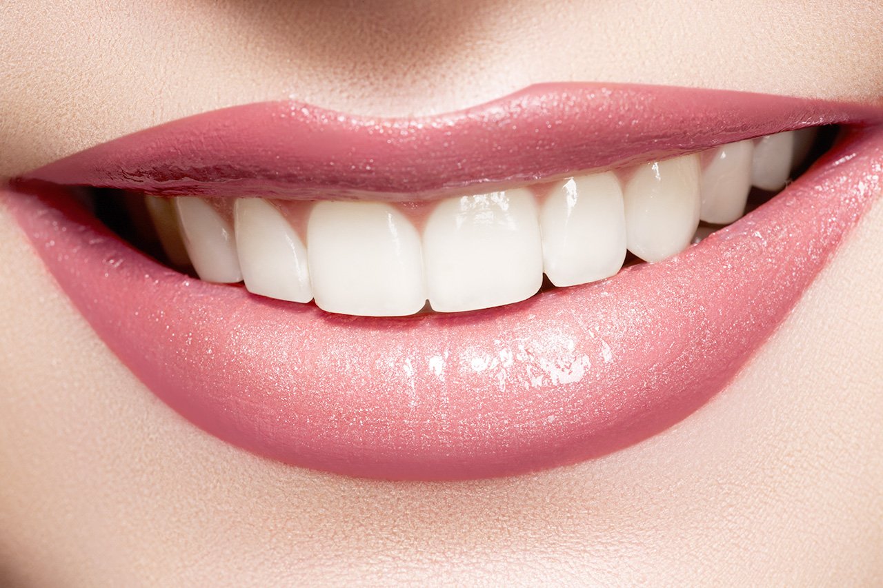 12 Benefits of Professional Teeth Whitening