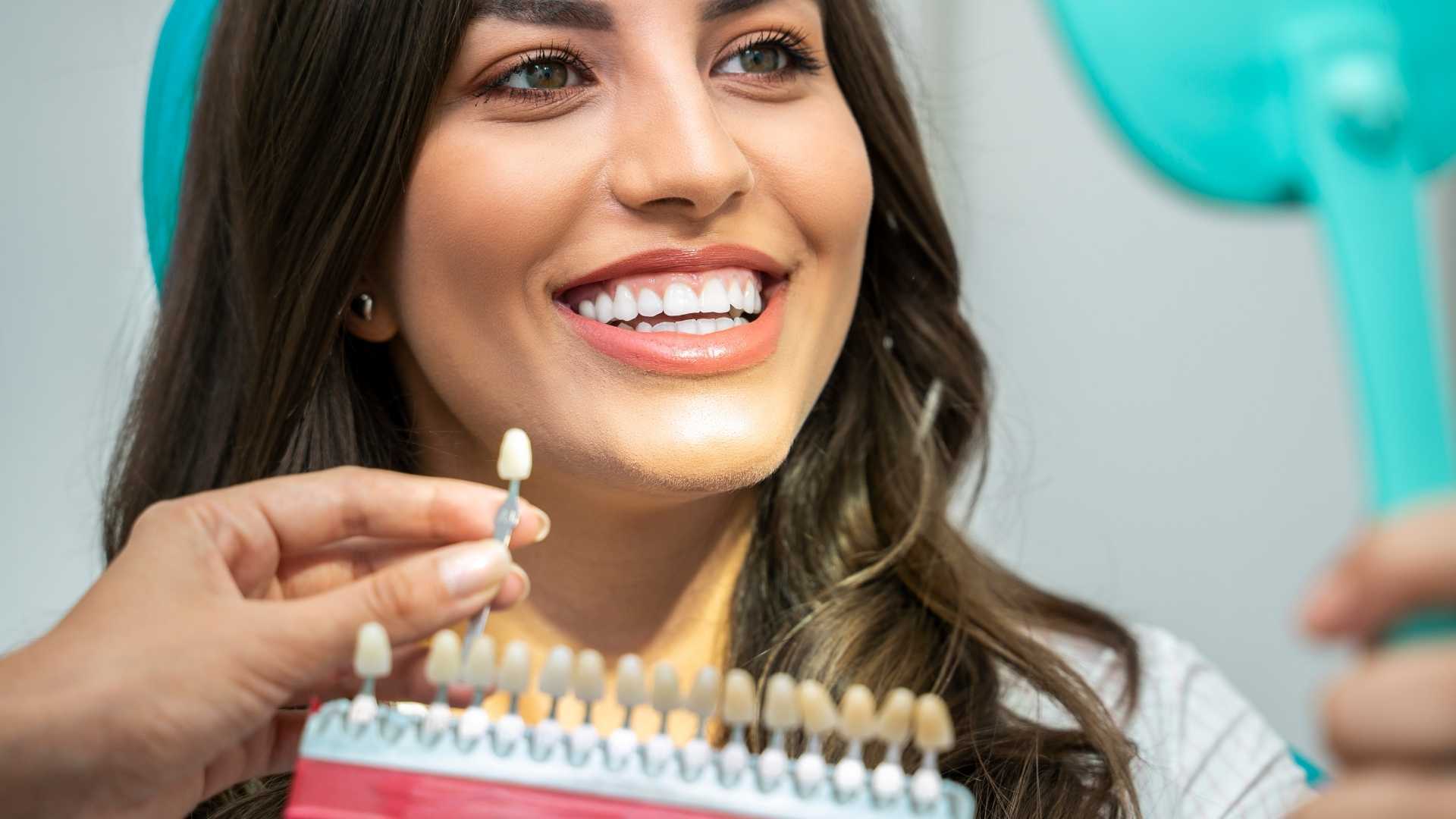 Composite fillings may be more difficult to set than porcelain ones.