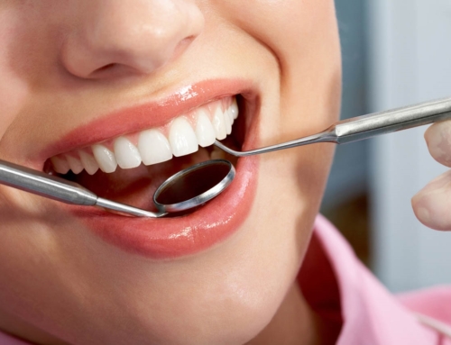 The Benefits Of Tooth-Colored Fillings